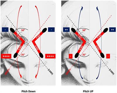 Downbeat nystagmus: a clinical and pathophysiological review